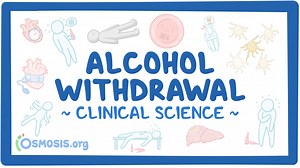 Alcohol withdrawal: Video & Meaning | Osmosis