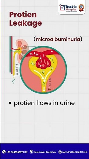 How Diabetes Affects Your Kidneys