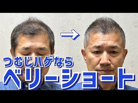 [Thinning Hair] Hairstyles to solve baldness on the top of the head