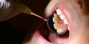 OT:Is That Biannual Dental Visit Necessary?