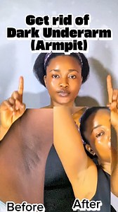 9.8K views · 60 reactions | Get rid of Dark underarm (armpit) | Skincare by Healthy Woman Secret | Facebook