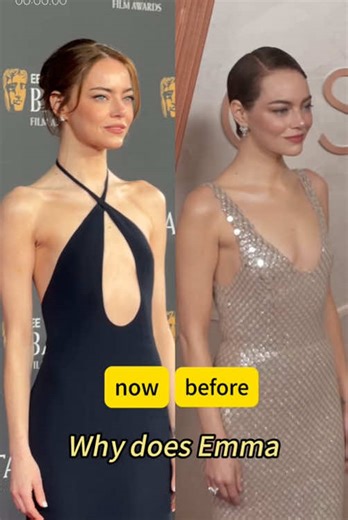 Emma Stone: Two Looks, One Star