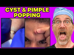 Plastic Surgeon Reacts To SATISFYING Pimple and Cyst Popping