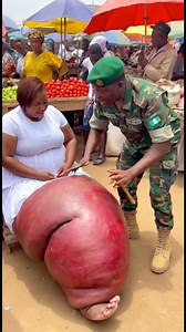 She fine now and healed from the stress 🙏 : : : : : : : : Disclaimer ⚠️ AI-generated content for educational and storytelling purposes only. Scenes may be simulated and are not real medical, spiritual, or professional evidence. Viewer discretion advised. This is not real and pls do not take it as real #fyp #love #viral | Funny mouthpiece comedy