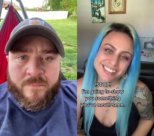 Understanding Marcus Gunn Phenomenon: Eyelid Nerve Connected to Jaw