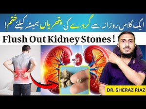MAGIC DRINK : Best Way to Prevent Kidney Stones | Kidney Stones ka ilaj | Dr.Sheraz Riaz