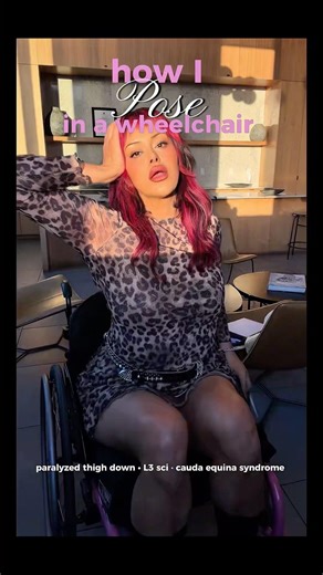 how I pose with thigh down paralysis (L3 sci • cauda equina syndrome) #disabledmodel #wheelchair