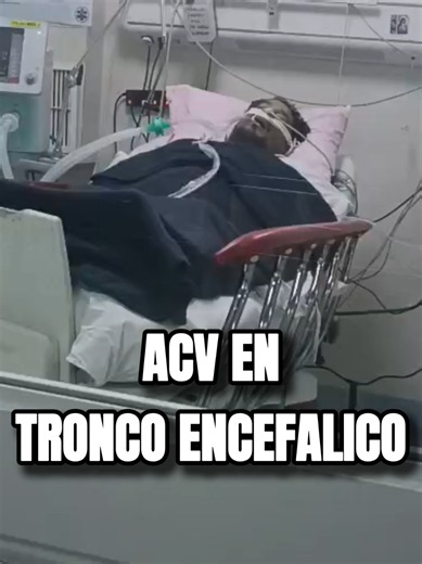 El ACV en el tronco encefálico es considerado uno , la conciencia y la comunicación entre el cerebro y el resto del cuerpo. Una lesión en esta zona puede provocar parálisis severa, alteraciones de la deglución, dificultades respiratorias e incluso poner en riesgo la vida. Aún hay camino por recorrer para lograr una mayor independencia ,pero tanto Carlos y yo ,seguiremos luchando. #acv #rehabilitacionneurologica #parati #viralvideo #inspiration