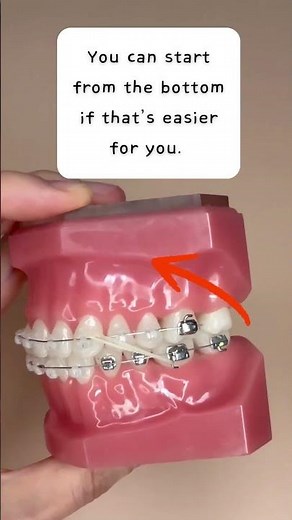 How to wear rubber bands with your braces