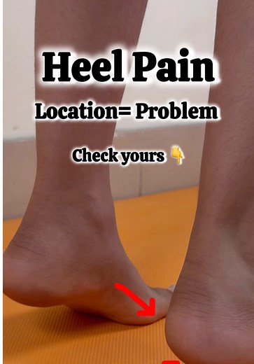 Heel Pain? Location Reveals the Problem | Physio Rehab Tips