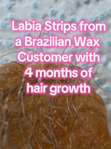 🔥🔥 Labia strips of hair from a Brazilian Wax 4 months growth