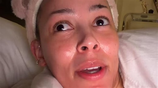 Doja Cat reveals she suspects she may have lipoedema