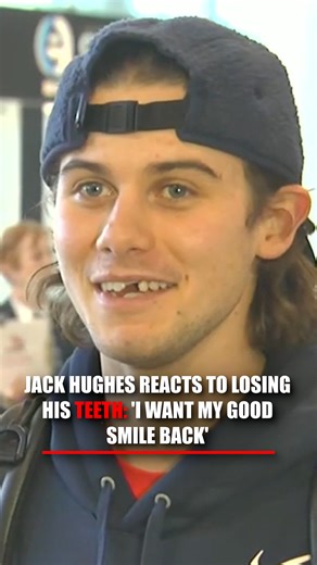 GAPS AND GLORY: Olympian Jack Hughes recalls the moment he lost his teeth, saying there was no question that he was going to continue playing. "Can you give us a smile?" JACK HUGHES: "No." | Fox News