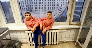 One Was A Psychopath, One Was An Empath: Conjoined Twins Trapped In The Same Body