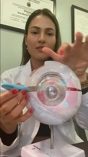 ¿Cómo se hace una vitrectomía? (cirugía de retina y vítreo). Dra. Lina Ramírez, retinóloga