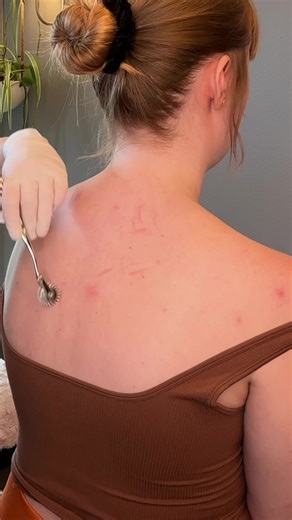 ASMR her dermatomes are all over the place @Caitlin 🌸 #realpersonasmr #asmr #asmrunintentional #asmrdoctorroleplay #madpasmr #asmrrealperson #asmrchiropractic #asmrchiropractor #asmrmedicalexam #asmrsensations #asmrsharpordull