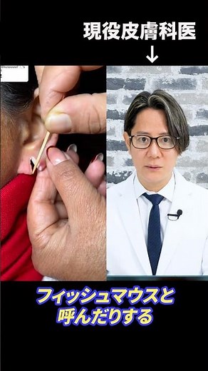 A practicing dermatologist explains the treatment methods for fish mouths #shorts