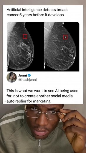 Artificial intelligence detects breast cancer 5 years before it develops. | Meme React