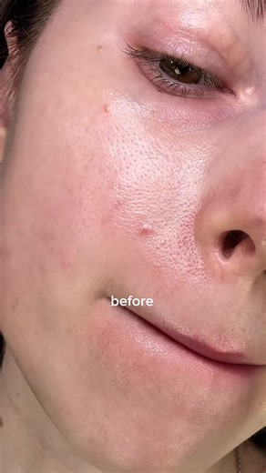 😫 ¿Tu rutina tiene 8 pasos y aún así tu piel no mejora? Menos productos, más estrategia. Como la vida en México: simple pero intensa. PAPAFEEL Dúo Facial: dos pasos, resultados completos. 1️⃣2️⃣ Paso 1 (día): 5X Ceramidas para una base fuerte contra el clima y la contaminación. Paso 2 (noche): 3X Retinol para una renovación profunda mientras sueñas. Para las que quieren resultados sin complicaciones. Para las que saben que menos es más. ¡La rutina que realmente funciona! ✅ #papafeel #papafeelmx