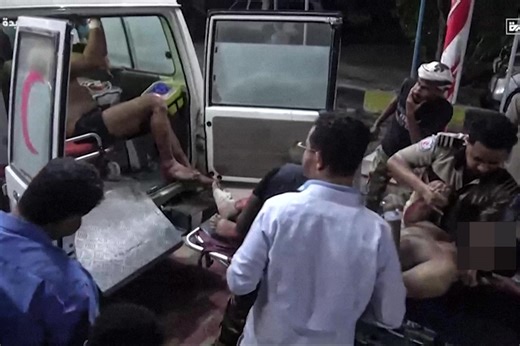 US air strikes kill 80, injure 150 in Yemen