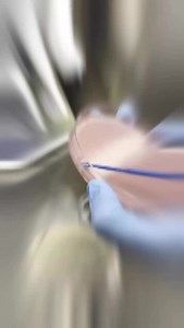 RAMBACH Agar is specifically designed for the differentiation of Salmonella species. The agar is chromogenic, providing two chromogenic substrates – propylene glycol and X-Gal ((5-bromo-4-chloro-3-indoyl- β-D-galactopyranoside). Certain Salmonella species act on the propylene glycol producing acid which causes the pH indicator in the media to change color, and pinkish-red or crimson colonies appear. #microbiology #microbiologist #microbiologylab #explorepage #bacteriology #microbe #science #mole