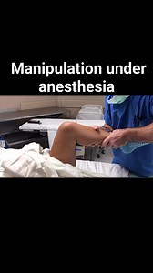Knee manipulation under anesthesia | PHYSIO-graphy