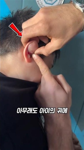 The truth behind the moving lump in the ear: The secret of cauliflower ears