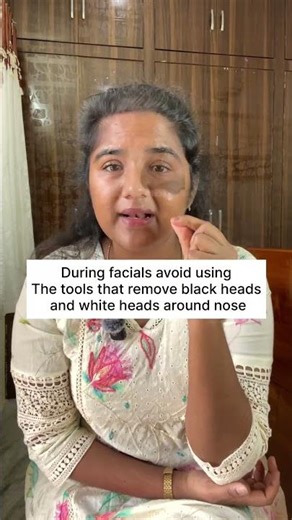 Dark nose side pigmentations-how to cure pigmentation around nose, creams to use for dark nose