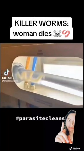 173K views · 2.9K reactions | Killer worms: woman dies after a 3.9 inch parasite was discovered EATING her kidneys. MANY health issues can be rooted in a misdiagnosed parasitic infection. It is common sense to deworm regularly, do your due diligence and research into safe deworming options. #holistichealth #holisticlifestyle #naturalsolutions #parasite #tapeworm #deworming #deworm #herbalism #detoxing #detoxtothrive #detoxcleanse | WOW PBX | Facebook