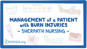 Video Case Study - Caring for Patients With Burn Injuries: Video, Causes, & Meaning | Osmosis
