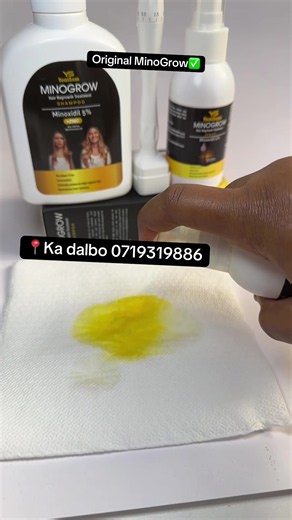 Minogrow Minoxidil Hair Growth Results — Before & After