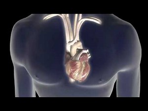 Atrial Fibrillation Animation