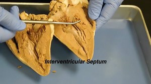 Anatomy of the Sheep's Heart
