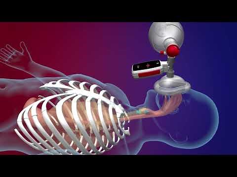 What is Tidal Volume ?