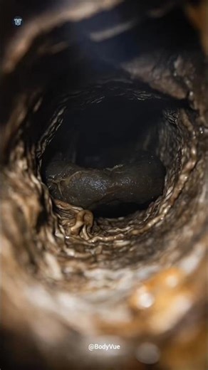 Gut Constipation & Stool Movement 3d Animation #anatomy #guthealth