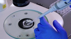 Whole Ovary Immunofluorescence, Clearing, and Multiphoton Microscopy for Quantitative 3D Analysis of the Developing Ovarian Reserve in Mouse