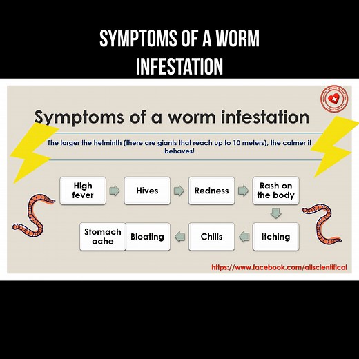 Symptoms of a worm infestation #worm #infestation #helminth #parasitology | About health and science in simple words