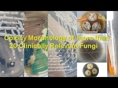 Fungal Colony morphology of more than twenty most common fungi