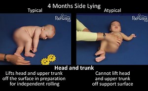 2.3K views · 26 reactions | How should a 4 month old baby's head and...