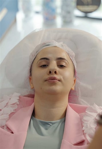 საოცნებო ცხვირი გავიკეთე, მართალია ხოტა უნდა ჩაცხრეს თუმცა ძალიან მომწონს @ESTHETIC LINE VIP CLINIC Camera/edit @Stepan Chuprunov #ziziamiranashvili #georgia🇬🇪 #makeupartist #nose