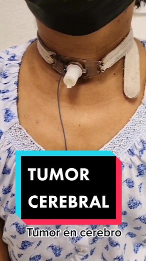 Rehabilitación después de resección de tumor en cerebro