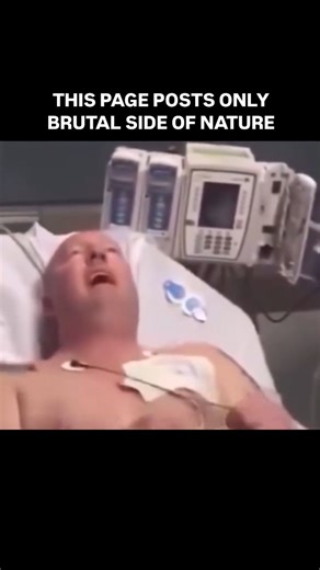 Brutal Side of Nature | It’s important to understand the difference between clinical death and biological death. Clinical Death – When the heart stops beating and... | Instagram