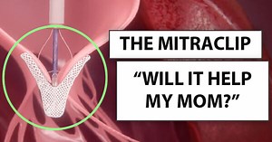 “Will The MitraClip Help My Mom?” asks Brian
