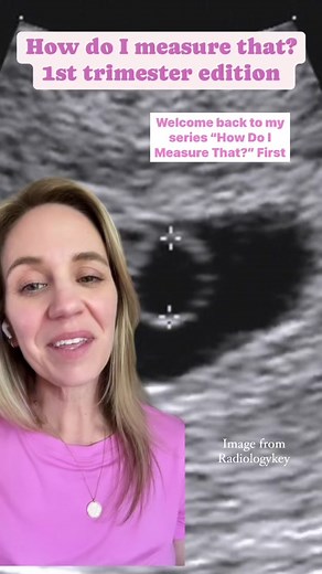 How to measure the yolk sac on that #firsttrimester #ultrasound for #sonographers. #ultrasoundtech #ultrasoundstudent #pregnant