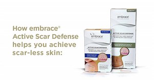 56K views · 15 reactions | embrace® Active Scar Defense uses state-of-the-art technology to actively prevent scar formation in 3 unique ways. It 1) mends the skin by relieving tension, 2) uses Stress-Shield™ Technology to secure and stabilize your incision from everyday movement, and 3) hydrates and softens skin with restorative silicone. | Embrace Scar Therapy | Facebook