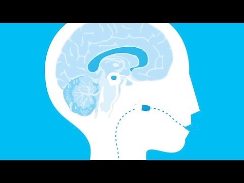Parkinson's drugs explained