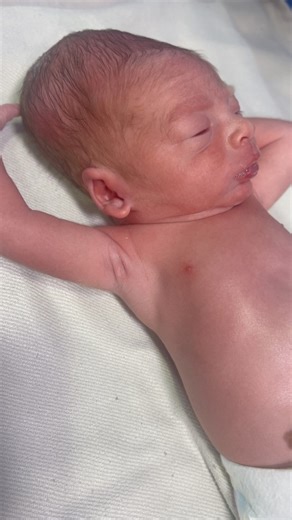 #babyfirstminutes #love #baby beautiful baby with caput succedaneum💖🥰👶🏻 | Baby first minutes