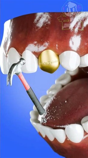 Can Wearing a Gold Tooth Be Dangerous?😱(Spanish Fandub) Zeck Felms in SPANISH #shorts #humor