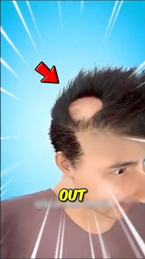 Why Your Arm Hair Refuses to Grow Longer 🤯