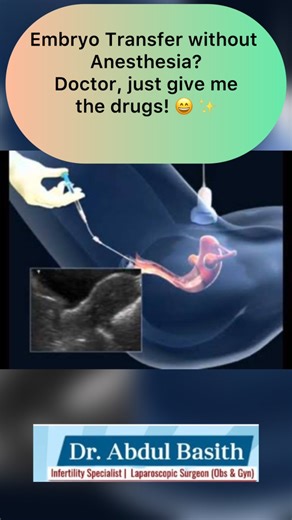 Think of your embryo transfer as the grand finale of your IVF journey! 🎉 It’s a surprisingly simple process—often taking just minutes—but its significance is HUGE. A well-executed transfer is like half the road crossed to that positive pregnancy test! 🏁 🤰 So, what makes a transfer successful? It’s all about technique! A tricky transfer can reduce success chances. This includes: ➡️ Trauma to the Lining: Bumping the uterine wall. ➡️ Cervical Challenges: A difficult-to-navigate cervix. ➡️ Mucus 